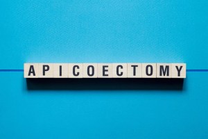 “Apicoectomy” written in blocks set against a bright blue background